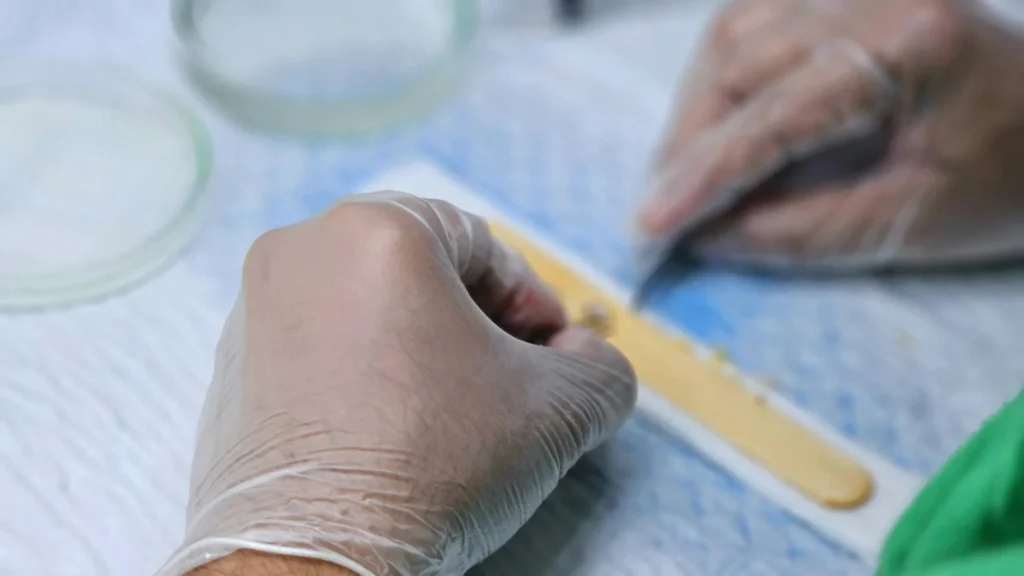 FUE Hair Transplant in 2026: The Real Cost Revealed