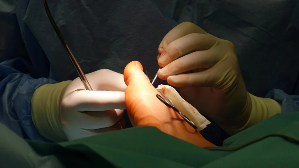 Liposuction in 2026: Current Trends, Techniques, and Costs