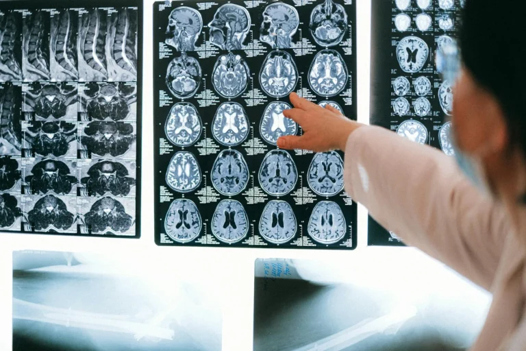 MRI & CT Scan Costs in 2026: What to Expect When You Pay