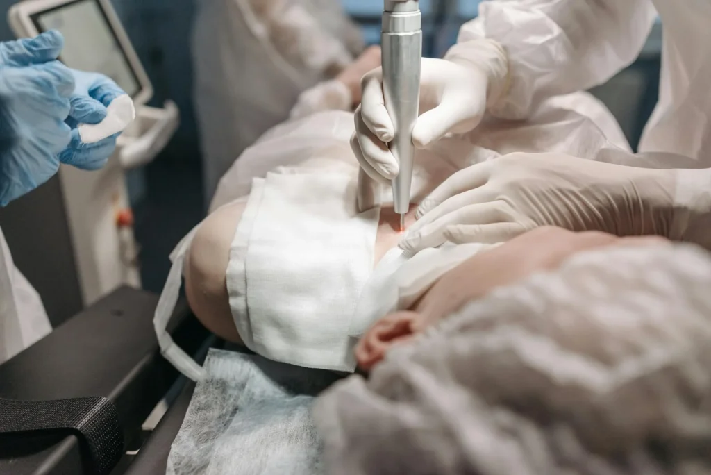 Liposuction in 2026: Current Trends, Techniques, and Costs