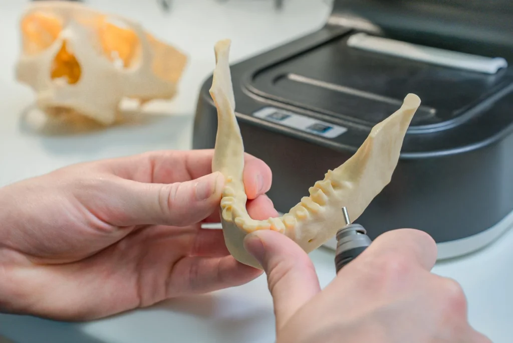 The Real Cost of Dental Implants in 2026: A Complete Guide