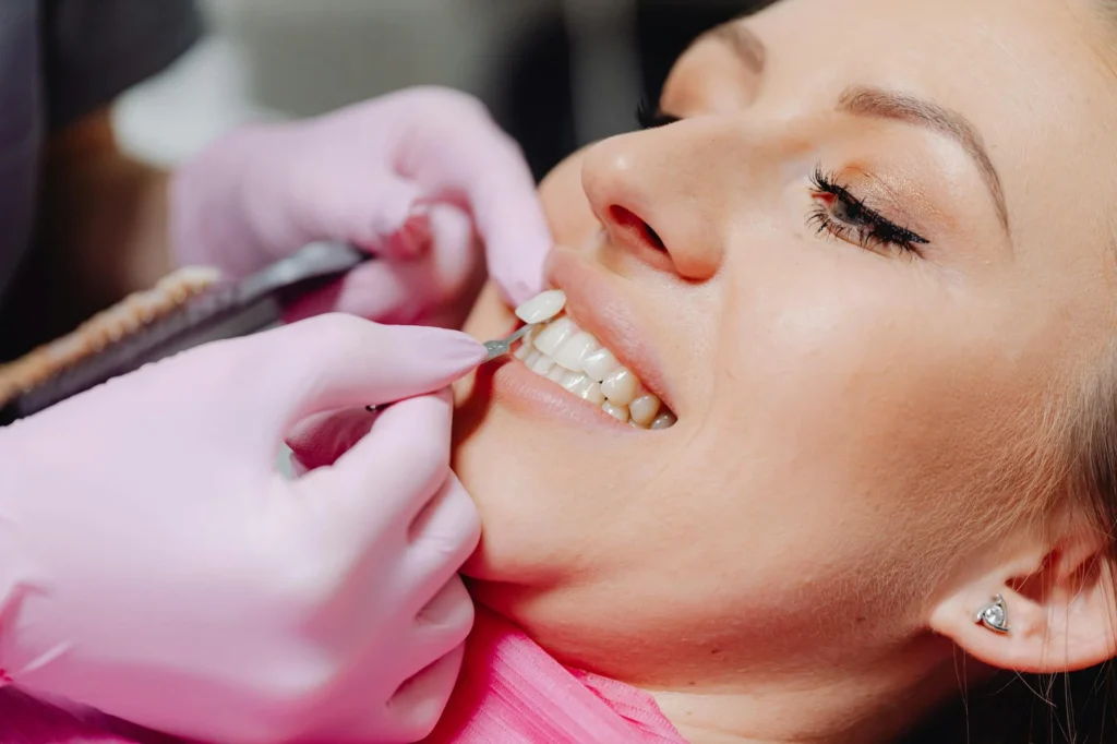 Smile Makeover: The Real Cost of Veneers in 2026