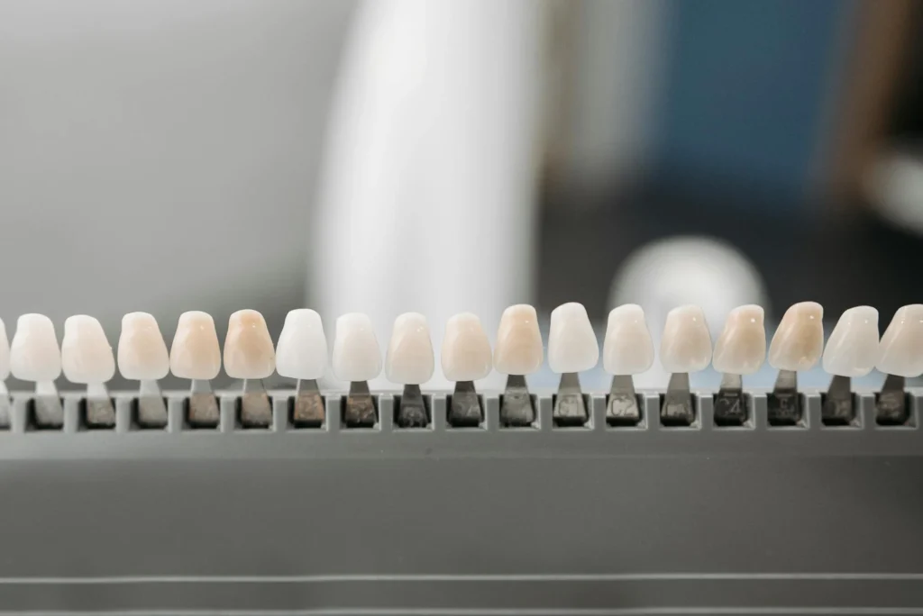 Smile Makeover: The Real Cost of Veneers in 2026