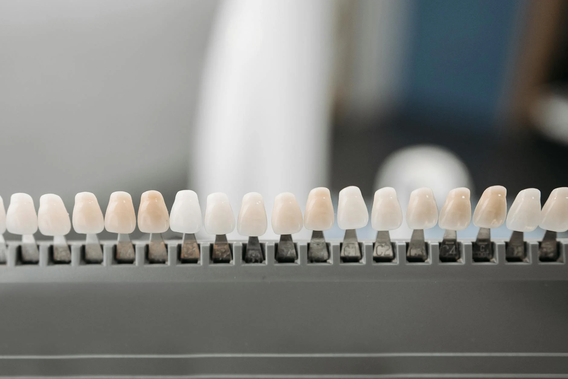 Smile Makeover: The Real Cost of Veneers in 2026