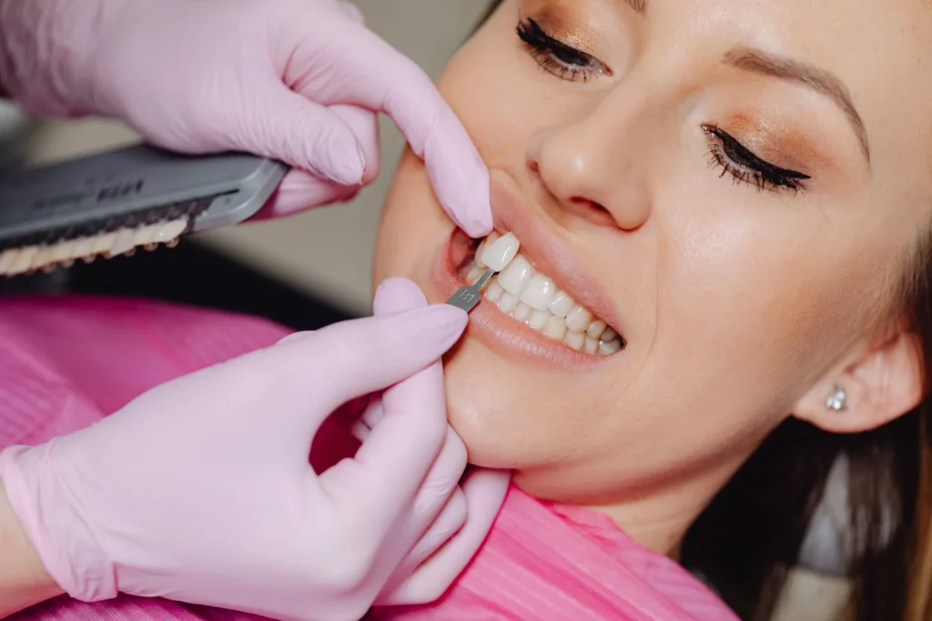 Veneers Cost 2026: What to Expect for Your Dream Smile