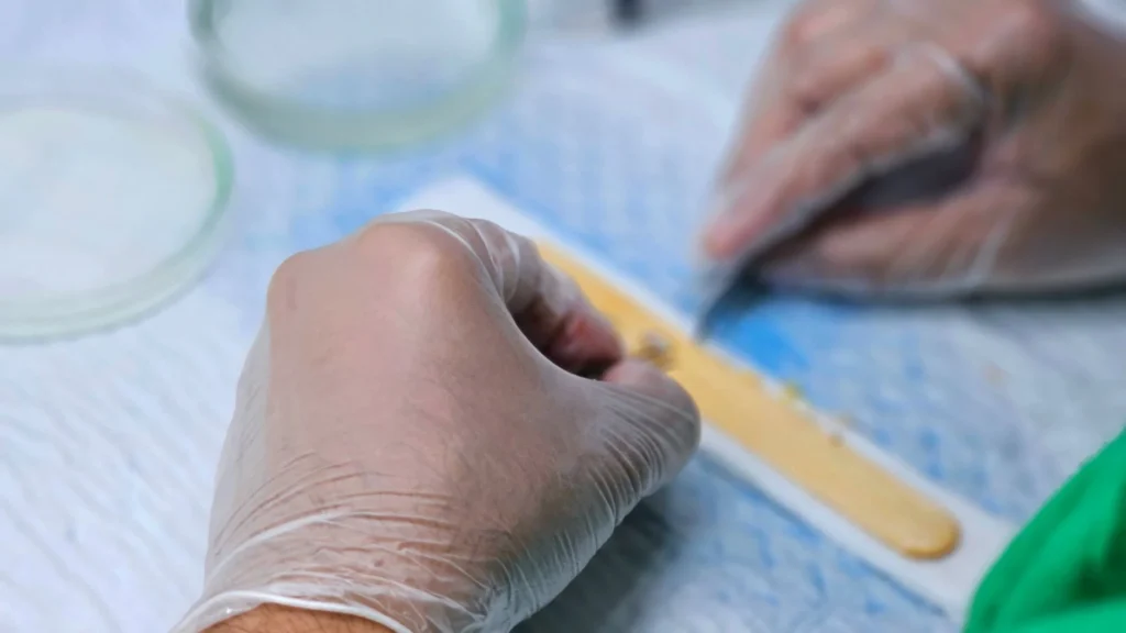 FUE Hair Transplant: What's the Real Cost Today?