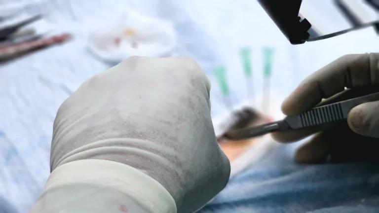 Current FUE Hair Transplant Cost: Is It Worth the Investment?